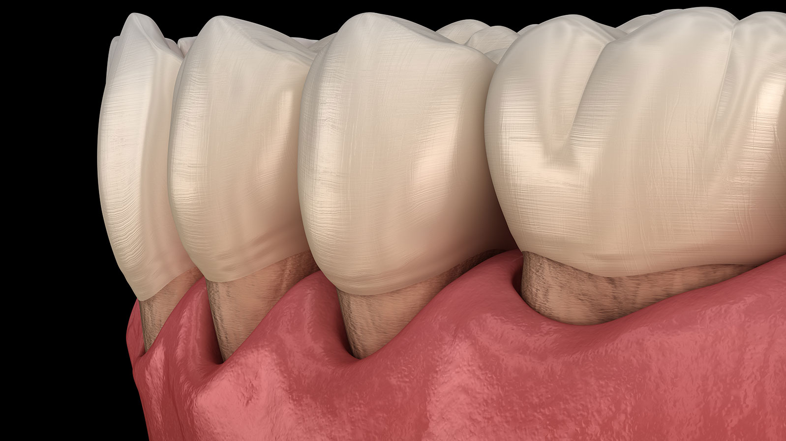 periodontology11